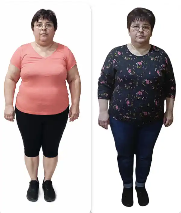 Judita Before and After